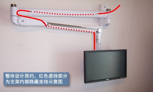 arm_bracket_01.jpg
